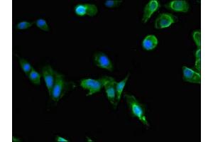 Immunofluorescent analysis of Hela cells using ABIN7163601 at dilution of 1:100 and Alexa Fluor 488-congugated AffiniPure Goat Anti-Rabbit IgG(H+L) (PAFAH1B1 抗体  (AA 40-155))