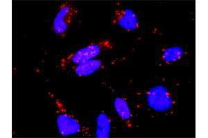 Proximity Ligation Analysis of protein-protein interactions between RASGRP4 and RAP1A. (RAP1A 抗体  (AA 1-184))