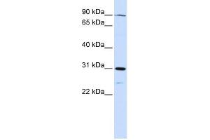LONRF3 antibody used at 1 ug/ml to detect target protein. (LONRF3 抗体  (N-Term))