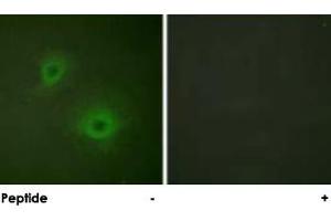 Immunofluorescence analysis of HUVEC cells, using EPHB1/EPHA2 polyclonal antibody . (EPH Receptor B1 抗体)