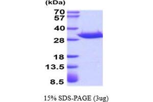 Acidic (Leucine-Rich) Nuclear phosphoprotein 32 Family, Member A (ANP32A) (AA 1-249) protein (His tag)
