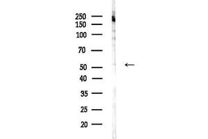 anti-Carboxypeptidase N Subunit 1 (CPN1) (C-Term) antibody