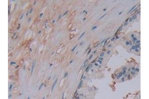 Detection of ChAT in Human Prostate Tissue using Polyclonal Antibody to Choline Acetyltransferase (ChAT)