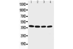 Anti-EIF2S2 antibody, Western blotting Lane 1: M451 Cell Lysate Lane 2: JURKAT Cell Lysate Lane 3: HELA Cell Lysate Lane 4:293T Cell Lysate (EIF2S2 抗体  (C-Term))