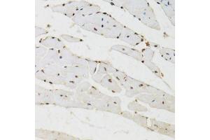 Immunohistochemistry of paraffin-embedded mouse heart using BAZ1B antibody (ABIN6003583) at dilution of 1/100 (40x lens). (BAZ1B 抗体)