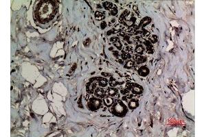 Immunohistochemistry (IHC) analysis of paraffin-embedded Human Breast, antibody was diluted at 1:100. (p53 抗体  (2meLys370))