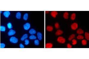 Immunofluorescence analysis of 293T cells using MonoMethyl-Histone H3-K27 Polyclonal Antibody (Histone 3 抗体  (meLys27))