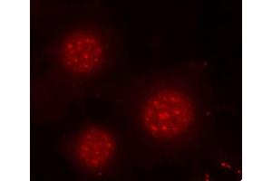 Immunofluorescence staining of methanol-fixed MCF-7 cells using Phospho-FOXO4-S197 antibody (ABIN2987524). (FOXO4 抗体  (pSer197))