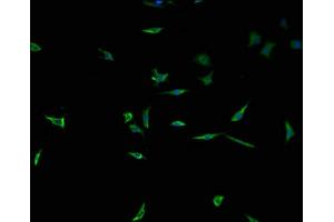 Immunofluorescence staining of SH-SY5Y cells with ABIN7173488 at 1:100, counter-stained with DAPI. (Tpp2 抗体  (AA 1-300))