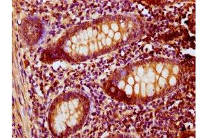 IHC image of ABIN7146432 diluted at 1:200 and staining in paraffin-embedded human appendix tissue performed on a Leica BondTM system. (PNCK 抗体  (AA 1-115))