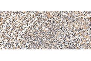 Immunohistochemistry of paraffin-embedded Human tonsil tissue using MRPS18C Polyclonal Antibody at dilution of 1:25(x200) (MRPS18C 抗体)