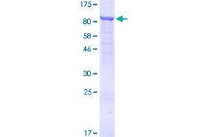 TTC30A Protein (AA 1-665) (GST tag)