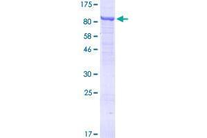 TTC30A Protein (AA 1-665) (GST tag)