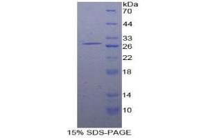 SDS-PAGE analysis of Human SLAMF5 Protein. (Signaling Lymphocytic Activation Molecule Family, Member 5 蛋白)