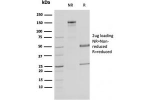 SDS-PAGE Analysis Purified MDH1 Mouse Monoclonal Antibody (CPTC-MDH1-1). (MDH1 抗体)