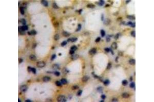 Used in DAB staining on fromalin fixed paraffin-embedded Kidney tissue (COL6A1 抗体  (AA 828-1022))
