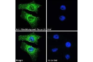 (ABIN238569) Immunofluorescence analysis of paraformaldehyde fixed HeLa cells, permeabilized with 0. (FGF21 抗体  (Internal Region))