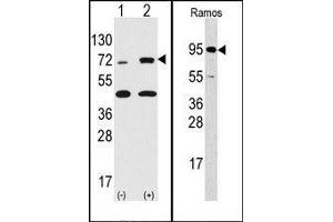 Image no. 1 for anti-Ribosomal Protein S6 Kinase, 90kDa, Polypeptide 3 (RPS6KA3) (N-Term) antibody (ABIN360345) (RPS6KA3 抗体  (N-Term))
