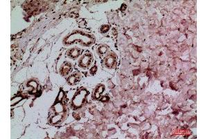 Immunohistochemistry (IHC) analysis of paraffin-embedded Human Skin, antibody was diluted at 1:100. (IL-1 beta 抗体  (Internal Region))