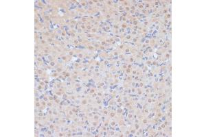 Immunohistochemistry of paraffin-embedded rat ovary using CDK9 antibody (ABIN6129241, ABIN6138331, ABIN6138332 and ABIN6214015) at dilution of 1:100 (40x lens).