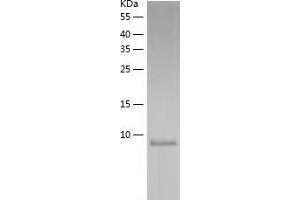 Western Blotting (WB) image for S100 Calcium Binding Protein A16 (S100A16) (AA 1-103) protein (His tag) (ABIN7124953) (S100A16 Protein (AA 1-103) (His tag))