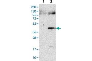 Western blot analysis of Lane 1: Negative control (vector only transfected HEK293T lysate). (ASPHD2 抗体)