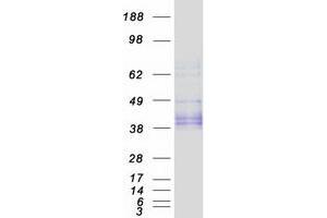 Western Blotting (WB) image for Osteoglycin (OGN) (Transcript Variant 1) protein (Myc-DYKDDDDK Tag) (ABIN2726015)
