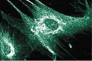 Immunofluorescence staining of human intestinal smooth muscle cells (HISM). (ANKS1B 抗体  (AA 107-268))