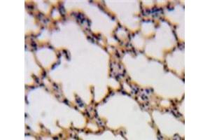 Used in DAB staining on fromalin fixed paraffin-embedded Lung tissue (SH2D1A 抗体  (AA 18-115))