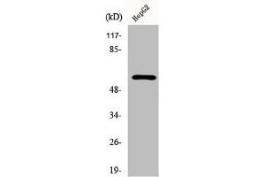 Western Blot analysis of 293 cells using Dab1 Polyclonal Antibody (DAB1 抗体)