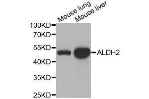 Western blot analysis of extracts of various cell lines, using ALDH2 antibody. (ALDH2 抗体  (AA 1-380))