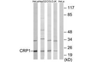 Western Blotting (WB) image for anti-Cysteine and Glycine-Rich Protein 1 (CSRP1) (AA 51-100) antibody (ABIN2879142) (CSRP1 抗体  (AA 51-100))