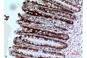 Immunohistochemical analysis of paraffin-embedded human-colon, antibody was diluted at 1:100. (FOXP3 抗体  (C-Term))