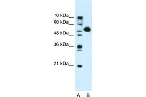Western Blotting (WB) image for anti-DKFZP781I1119 antibody (ABIN2461018) (DKFZP781I1119 抗体)