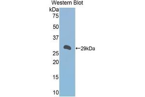 Western blot analysis of the recombinant protein. (A1BG 抗体  (AA 22-219))