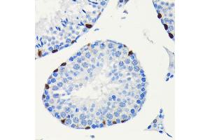 Immunohistochemistry (IHC) image for anti-SRY (Sex Determining Region Y)-Box 9 (SOX9) antibody (ABIN7270577)