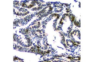 IHC analysis of NFIA using anti-NFIA antibody (ABIN6719349). (NFIA 抗体  (Middle Region))