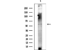 Western blot analysis of lysates from Rat lung, using AKT1 Mouse Monoclonal Antibody at 1/1000 dilution.