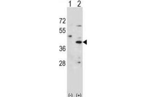 Western Blotting (WB) image for anti-Hydroxy-delta-5-Steroid Dehydrogenase, 3 beta- and Steroid delta-Isomerase 1 (HSD3B1) antibody (ABIN2998094) (HSD3B1 抗体)