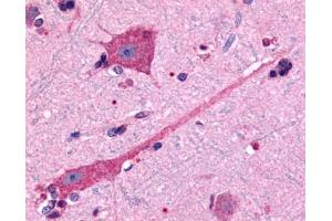 Anti-DRD2 antibody IHC of human brain, neurons and glia. (Dopamine d2 Receptor 抗体  (Cytoplasmic Domain))