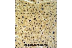 Immunohistochemistry (IHC) image for anti-FK506 Binding Protein 9, 63 KDa (FKBP9) antibody (ABIN3003182) (FKBP9 抗体)