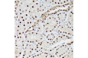 Immunohistochemistry of paraffin-embedded rat kidney using PSME3 Rabbit pAb (ABIN6135015, ABIN6146357, ABIN6146358 and ABIN6216428) at dilution of 1:100 (40x lens). (PSME3 抗体  (C-Term))