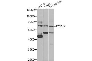 Western blot analysis of extracts of various cell lines, using DYRK2 antibody (ABIN5974219) at 1/1000 dilution. (DYRK2 抗体)