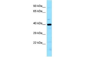 WB Suggested Anti-LIMS2 Antibody Titration: 1. (LIMS2 抗体  (N-Term))