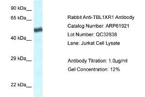 Western Blotting (WB) image for anti-Transducin (Beta)-Like 1 X-Linked Receptor 1 (TBL1XR1) (C-Term) antibody (ABIN2788949) (TBL1XR1 抗体  (C-Term))