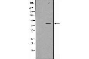 Western blot analysis of extracts from HepG2 cells, using ATP6V1B1 antibody. (ATP6V1B1 抗体  (Internal Region))