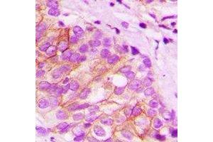 Immunohistochemistry (IHC) image for anti-TAP Binding Protein (Tapasin) (TAPBP) antibody (ABIN7308398) (TAPBP 抗体)