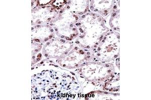 Immunohistochemistry (IHC) image for anti-Forkhead Box D1 (FOXD1) antibody (ABIN2997954) (FOXD1 抗体)