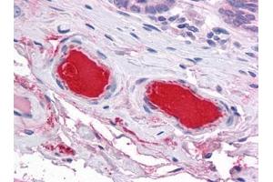 Human Small Intestine, Vessels: Formalin-Fixed, Paraffin-Embedded (FFPE) (C9 抗体)