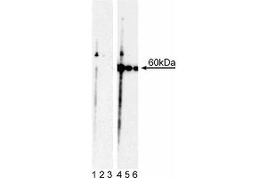 Western blot analysis of Akt (pT308). (AKT1 抗体  (pThr308))